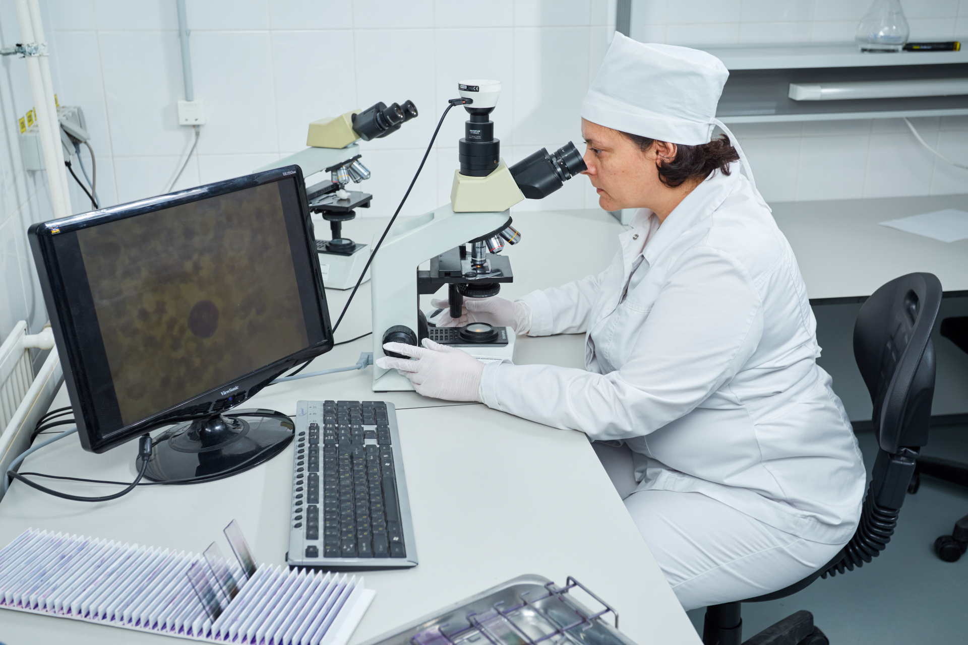 В лаборатории с начала текущего года проведено свыше 600 паразитологических и санитарно-паразитологических исследований