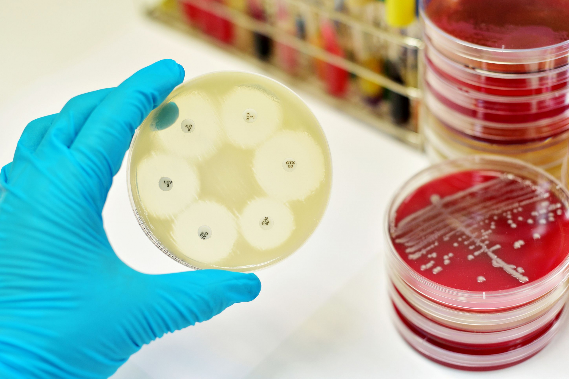 Свыше 1200 микробиологических исследований проведено отделом бактериологии и питательных сред в первой половине текущего месяца